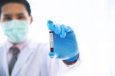 Bir virüsün kan damarlarını taşıyan doktor 2019-nCoV kan testi konsepti için test edilmek üzere hastaya hastalık bulaştırdı.