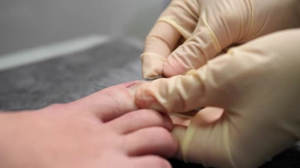 Podologie: Arzt nimmt Fußnägel-Peeling zur mikroskopischen Diagnostik in einer kosmetologischen Klinik. — Stockvideo