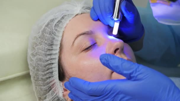 Fermer l'ablation laser des vaisseaux sanguins sur le visage dans une clinique de cosmétologie . — Video