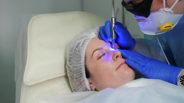 Extirpación láser de vasos sanguíneos en la cara en una clínica de cosmetología, Dermatoaenerología . — Vídeo de stock