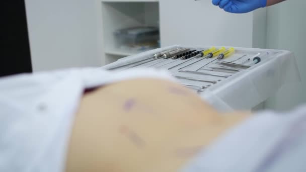 外科医はメスを取り、手術室でさらなる脂肪吸引のために腹部の切開の準備をします. — ストック動画
