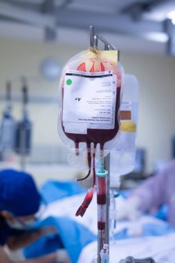 Acil serviste ya da hastanede infüzyon standında asılı duran kırmızı hücre kan nakil torbasını paketle. Solgun hastaya kan değişimi ve şok tedavisi, akut kan kaybı...