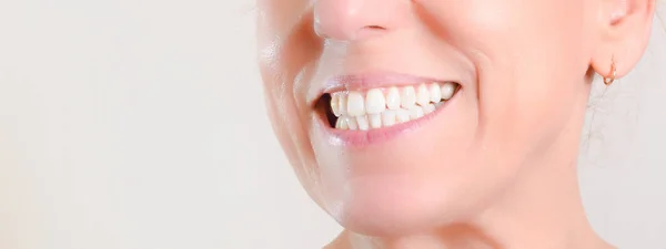 Mulher madura mostrando dentes brancos naturais perfeitos no lado — Fotografia de Stock