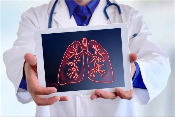 Arts met longen op een Tablet in de voorkant close-up — Stockfoto
