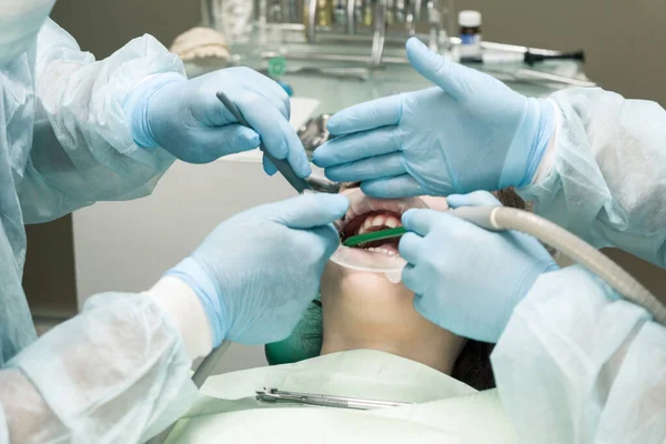 Menina Com Boca Aberta Recebendo Tratamento Odontológico Close Tratamento Dentário — Fotografia de Stock