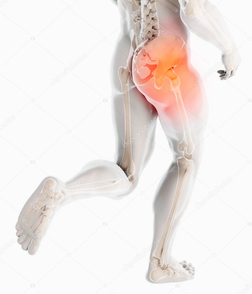 3D illustration, hip painful skeleton x-ray, medical concept.