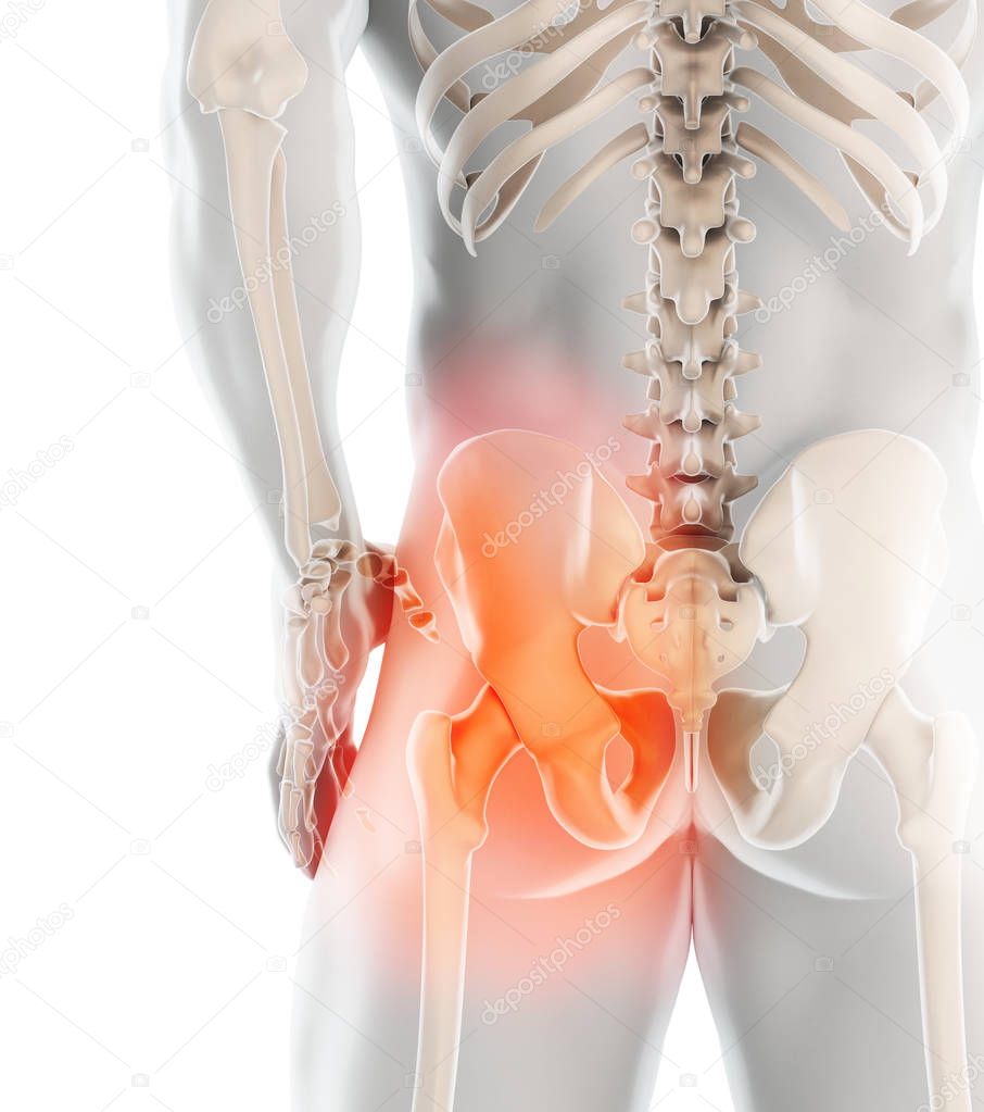 3D illustration, hip painful skeleton x-ray, medical concept.