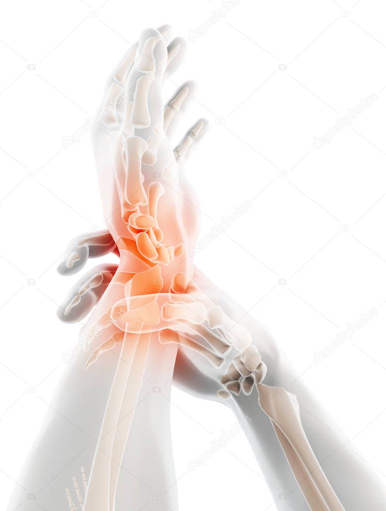 Wrist painful - skeleton x-ray, 3D Illustration medical concept.