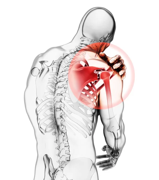 Ilustración Hombro Doloroso Esqueleto Rayos Concepto Médico — Foto de Stock