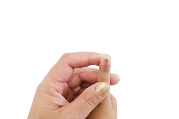 Wart Papilloma Index Finger Child Isolated White Close — Stock Photo, Image