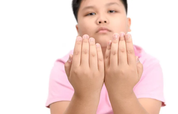 Disgusting Bitten Fingernails Boy Hand Isolated White Background Chronic Onychophagia — Stock Photo, Image