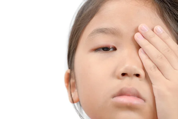 Κοντινό Πλάνο Της Ασίας Κοριτσάκι Ένα Μάτι Λοίμωξη Απομονώνονται Λευκό — Φωτογραφία Αρχείου