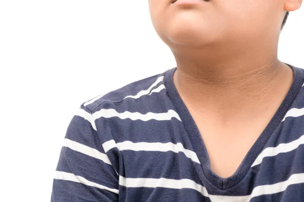 Black marks of the skin around the neck  of fat boy — Stock Photo, Image