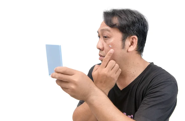 Homem aplicando creme no rosto com melasma — Fotografia de Stock