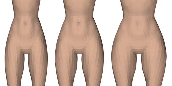 Illustration Vectorielle Avec Trois Types Taille Hanches Féminines Des Cuisses — Image vectorielle