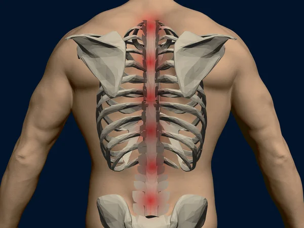 一个有骨架的人的矢量背。脊椎上的红色痛点。3d. 一个人的现实背影。向量例证 — 图库矢量图片