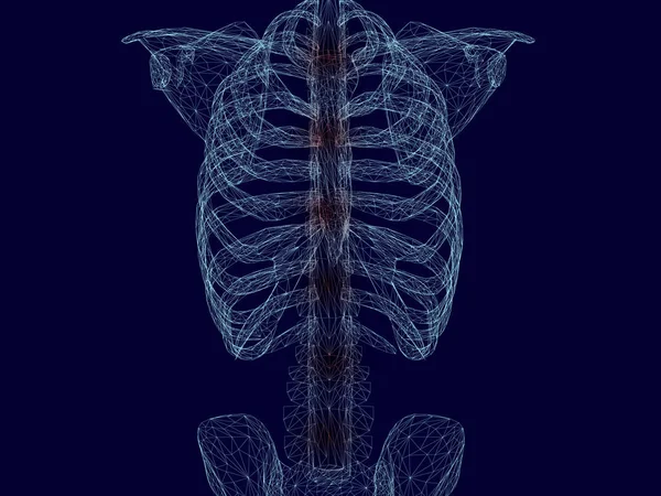 Estructura del pecho y la columna vertebral de un hombre de líneas azules sobre un fondo oscuro. Áreas inflamatorias rojas a lo largo de la columna. 3D. Ilustración vectorial — Vector de stock