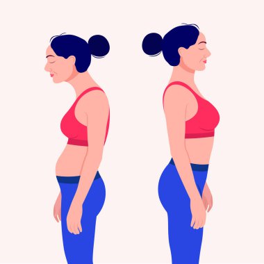 Woman with impaired posture position defect scoliosis and ideal bearing vector Illustration clipart