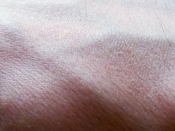 human skin texture closeup