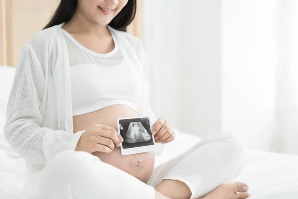 Mujer embarazada sosteniendo la imagen de la ecografía en su campana — Foto de Stock