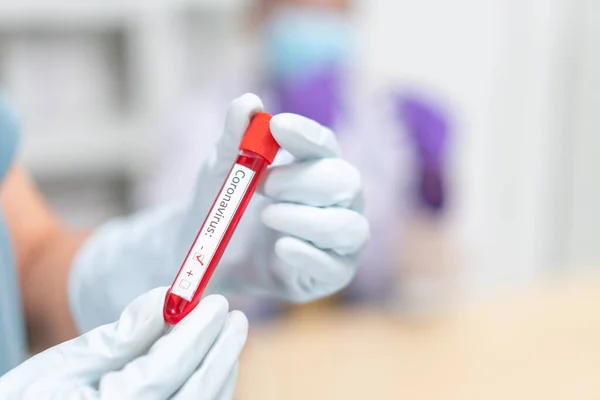 Enfermera Sosteniendo Tubo Prueba Con Sangre Para 2019 Ncov Analizando —  Fotos de Stock