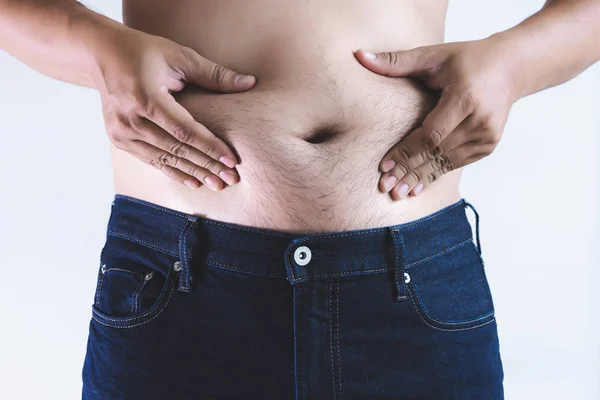 Mann Mit Übergewichtigem Dicken Bauch Mollig — Stockfoto