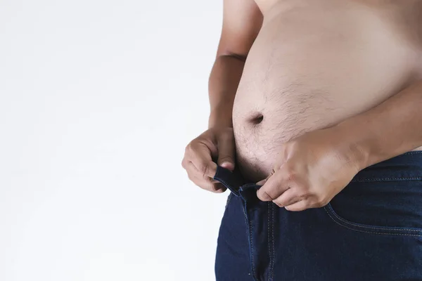 Mann Mit Übergewichtigem Dicken Bauch Mollig — Stockfoto