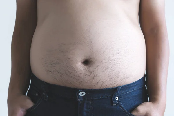 Mann Mit Übergewichtigem Dicken Bauch Mollig — Stockfoto