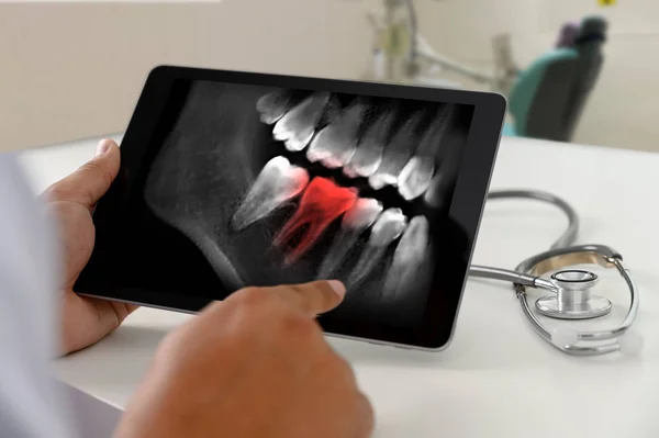 Dentysta dentystyczny narzędzie do zębów x-ray pracy patrząc na zęby X-ray O — Zdjęcie stockowe