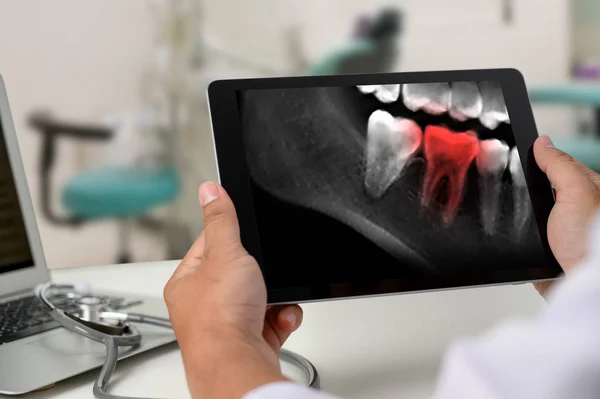 Dentysta dentystyczny narzędzie do zębów x-ray pracy patrząc na zęby X-ray O — Zdjęcie stockowe