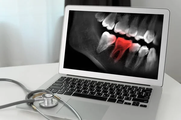 歯のX線作業に歯科医の歯科用ツール歯のX線Oを見て — ストック写真