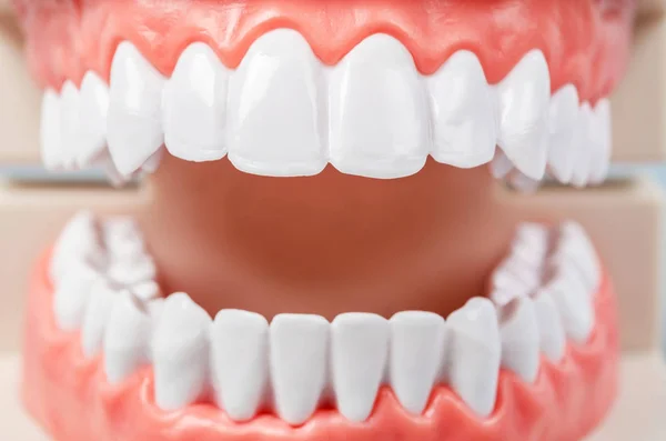 Primer Modelo Dientes Concepto Dental — Foto de Stock