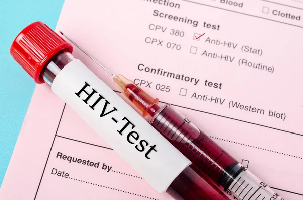 Örnek kan toplama tüp üzerinde sınama formu eleme HIV enfeksiyonu HIV testi etiketle.