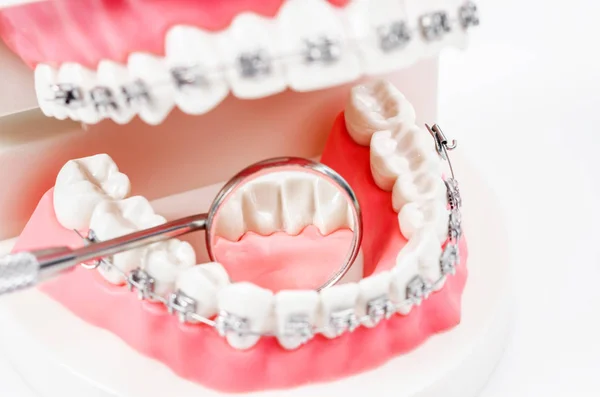 Modelo Dientes Con Abrazaderas Dentales Alambre Metálico Equipo Dental Espejo — Foto de Stock