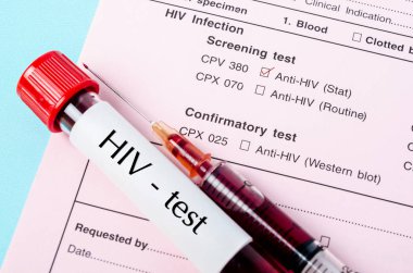 Kan tüpünde kan örneği, iğne ve s ile HIV testi etiketi.