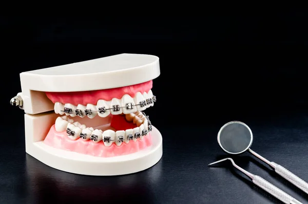 Juego Herramientas Equipamiento Médico Para Dentistas Metal Con Dientes Modelo — Foto de Stock