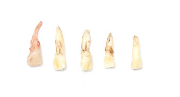 Perdita del dente da latte, del dente del bambino o del dente primario, isolato su — Foto Stock