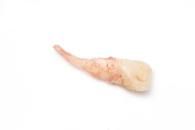 süt diş, bebek dişi veya primer diş, izole kaybetme 