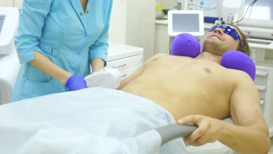 Erkek lazer epilasyon. bir doktor eldiven saç karın ve göğüs bir adamın kaldırır. 4k, yakın çekim.