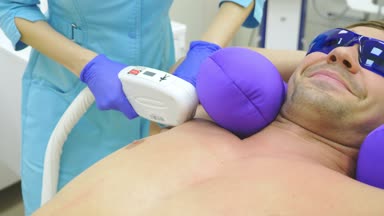 Erkek lazer epilasyon. bir doktor eldiven saç karın ve göğüs bir adamın kaldırır. 4k, yakın çekim.