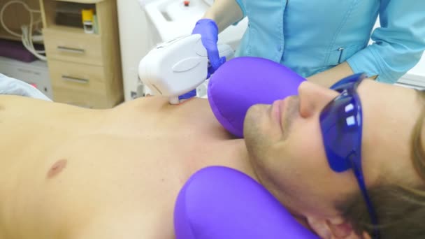 Pria laser rambut menghilangkan. seorang dokter dalam sarung tangan menghilangkan rambut dari perut dan payudara seorang pria. 4k, close-up . — Stok Video