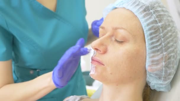 Kosmetolog läkaren gäller narkos grädde på framsidan av patienten innan förfarandet av contour plasty. 4k — Stockvideo