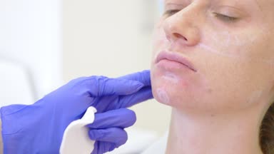 Bir plastik cerrahın elleri kontür hastalar yüzünde çizmek. 4 yüz kontur Plasti yordam için k..