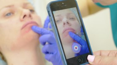 Birisi telefonda reklam sosyal ağlar için bir güzellik olarak çalışırken bir fotoğraf yapar. Sonuç önce ve sonra izleme. 4k