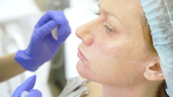 Косметолог делает уколы в лицо пациентке. концепция красоты и косметологии. 4k . — стоковое видео