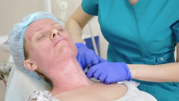 Kosmetička doktor dělá injekce tváří v tvář ženské pacienta. pojetí krásy a kosmetice. 4k. — Stock video