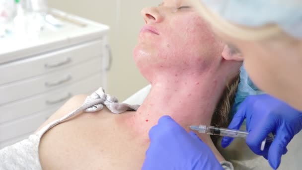 L'estetista di dottore fa iniezioni di fronte al paziente femminile. concetto di bellezza e cosmetologia. 4k . — Video Stock