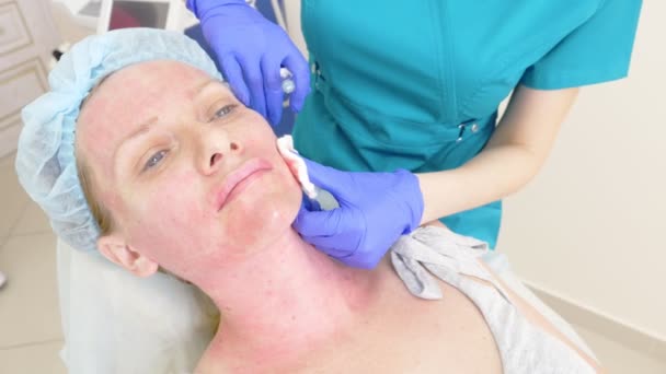 El médico esteticista hace inyecciones en la cara de la paciente femenina. concepto de belleza y cosmetología. 4k . — Vídeo de stock
