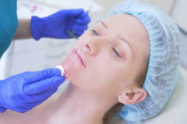 Doktor Şevval özçelik güzellik bayan hasta karşısında enjeksiyonları yapar. Güzellik ve kozmetik kavramı. 4k.