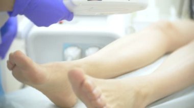 lazer epilasyon. Doktor eldiven. 4k, yakın çekim.